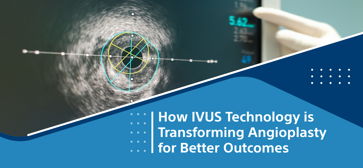 How IVUS Technology is Transforming Angioplasty for Better Outcomes